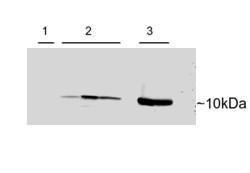 Anti-PVALB Antibody (A83606) (0.15 µg/ml) staining of adenovirus-mediated gene transfer in Rat Heart cells 1) Untransfected, 2) transient transfection with Human PVALB. 3) Untransfected Rat Skeletal Muscle. Detected by chemiluminescence