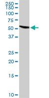 Anti-GC Rabbit Polyclonal Antibody