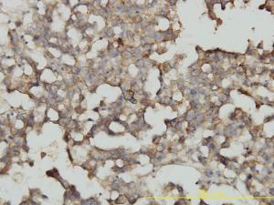 Anti-RRAS2 Mouse Monoclonal Antibody [clone: 2D3-4B8]