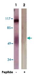 Anti-CTNND1 Rabbit Polyclonal Antibody