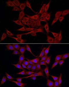 Immunofluorescence analysis of NIH/3T3 cells using Anti-ERp72 Antibody (A9438) at a dilution of 1:50 (40x lens). DAPI was used to stain the cell nuclei (blue).