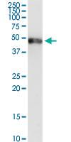 Anti-GC Rabbit Polyclonal Antibody