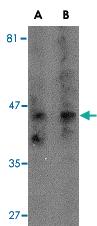 Anti-TACR3 Rabbit Polyclonal Antibody