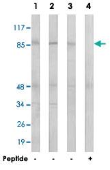 Anti-PNPLA8 Rabbit Polyclonal Antibody