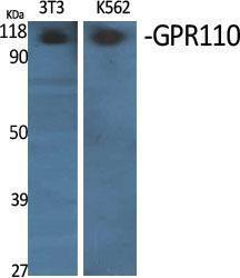 Western blot analysis of various cells using Anti-GPR110 Antibody