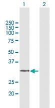 Anti-AMT Rabbit Polyclonal Antibody