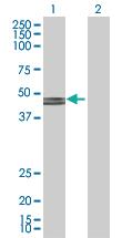 Anti-GCDH Mouse Polyclonal Antibody