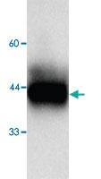 Anti-STMN1 Mouse Monoclonal Antibody [clone: 678r]