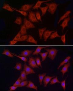 Immunofluorescence analysis of PC-12 cells using Anti-ERp72 Antibody (A9438) at a dilution of 1:50 (40x lens). DAPI was used to stain the cell nuclei (blue).