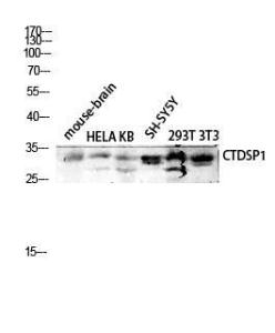 Anti-CTDSP1 Rabbit Polyclonal Antibody