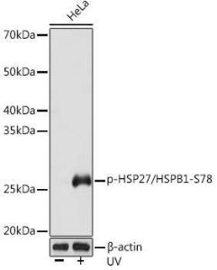 Western blot analysis of extracts of HeLa cells, using Anti-Hsp27 (phospho Ser78) Antibody [ARC1577] (A305364) at 1:1,000 dilution