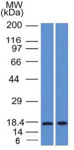 Antibody anti-GCDFP 15 PIP1571 100 µg