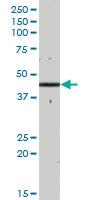 Anti-GCDH Mouse Polyclonal Antibody