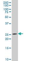 Anti-NKX3-1 Mouse Monoclonal Antibody [clone: 1C7]