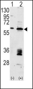 Anti-MDM2 Rabbit Polyclonal Antibody (AP (Alkaline Phosphatase))