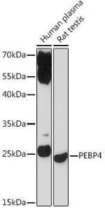 Western blot analysis of extracts of various cell lines, using Anti-Pebp4 Antibody (A93291) at 1:1,000 dilution. The secondary antibody was Goat Anti-Rabbit IgG H&L Antibody (HRP) at 1:10,000 dilution.