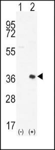 Anti-PIM2 Rabbit Polyclonal Antibody (HRP (Horseradish Peroxidase))