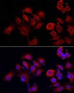 Immunofluorescence analysis of PC-3 cells using Anti-ERp72 Antibody (A9438) at a dilution of 1:50 (40x lens). DAPI was used to stain the cell nuclei (blue).