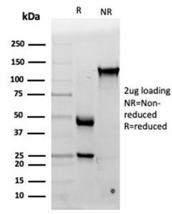 SDS-PAGE analysis of Anti-IL-15 Antibody [IL15/4353] under non-reduced and reduced conditions; showing intact IgG and intact heavy and light chains, respectively. SDS-PAGE analysis confirms the integrity and purity of the Antibody