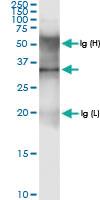 Anti-AMT Rabbit Polyclonal Antibody