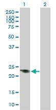 Anti-SRY Mouse Polyclonal Antibody