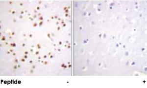 Anti-CTNND1 Rabbit Polyclonal Antibody