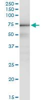 Anti-GTF2H1 Antibody Pair