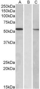 HEK293 lysate (10ug protein in RIPA buffer) overexpressing Human MGAT1 with C-terminal MYC tag probed with Anti-MGAT1 Antibody (A83608) (1 µg/ml) in Lane A and probed with anti-MYC Tag (1/1000) in lane C