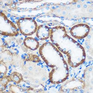 Immunohistochemistry analysis of paraffin-embedded mouse kidney using Anti-Pebp4 Antibody (A93291) at a dilution of 1:100 (40x lens). Perform microwave antigen retrieval with 10 mM PBS buffer pH 7.2 before commencing with IHC staining protocol.