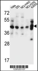 Anti-GTF2H2C Rabbit Polyclonal Antibody [clone: 235CT7.8.2.3]