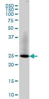 Anti-RAB3B Mouse Monoclonal Antibody [clone: 3F12]