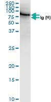 Anti-TGFBI Rabbit Polyclonal Antibody