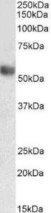 Anti-LILRA4 Antibody (A85256) (03 µg/ml) staining of Human Lymph Node lysate (35 µg protein in RIPA buffer) Primary incubation was 1 hour Detected by chemiluminescence