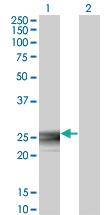 Anti-RAB3B Mouse Monoclonal Antibody [clone: 3F12]