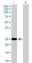 Anti-DUSP19 Mouse Polyclonal Antibody