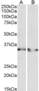 Anti-LDHB Antibody (A83610) (0.3 µg/ml) staining of Human Heart (A) and Human Kidney (B) lysates (35 µg protein in RIPA buffer). Primary incubation was 1 hour. Detected by chemilu minescence