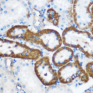 Immunohistochemistry analysis of paraffin-embedded rat kidney using Anti-Pebp4 Antibody (A93291) at a dilution of 1:100 (40x lens). Perform microwave antigen retrieval with 10 mM PBS buffer pH 7.2 before commencing with IHC staining protocol.