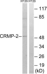 Western blot analysis of lysates from HT-29 cells, treated with heat shock using Anti-CRMP-2 Antibody. The right hand lane represents a negative control, where the antibody is blocked by the immunising peptide