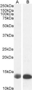 Anti-FABP1 Goat Polyclonal Antibody