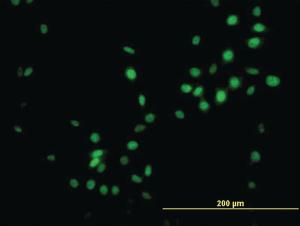 Anti-NKX3-1 Mouse Monoclonal Antibody [clone: 1C7]