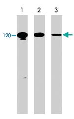 Anti-CDH1 Rabbit Polyclonal Antibody