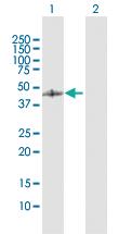 Anti-GCDH Rabbit Polyclonal Antibody