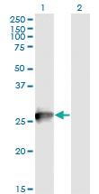 Anti-RAB3B Mouse Monoclonal Antibody [clone: 1A7]