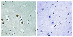 Immunohistochemical analysis of paraffin-embedded human brain tissue using Anti-CRMP-2 Antibody. The right hand panel represents a negative control, where the antibody was pre-incubated with the immunising peptide