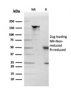 SDS-PAGE analysis of Anti-Apolipoprotein D Antibody [APOD/3412] under non-reduced and reduced conditions; showing intact IgG and intact heavy and light chains, respectively. SDS-PAGE analysis confirms the integrity and purity of the antibody