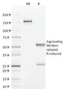 Antibody anti-GCDFP 15 PIP1571 100 µg