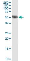 Anti-AMY1A Mouse Monoclonal Antibody [clone: 2D4]