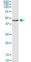 Anti-GCDH Rabbit Polyclonal Antibody