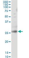 Anti-RAB3B Mouse Monoclonal Antibody [clone: 1A7]