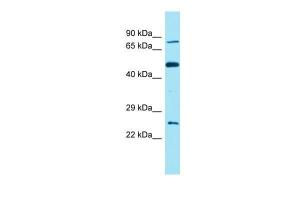 Anti-FAM111B Rabbit Polyclonal Antibody